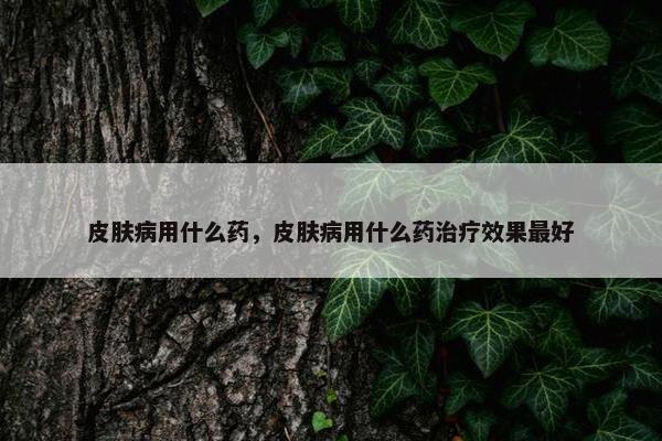 皮肤病用什么药，皮肤病用什么药治疗效果最好