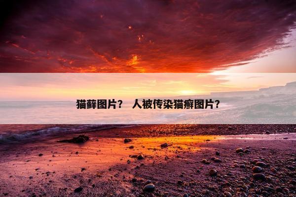 猫藓图片？ 人被传染猫癣图片？