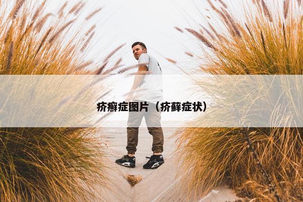 疥癣症图片（疥藓症状）