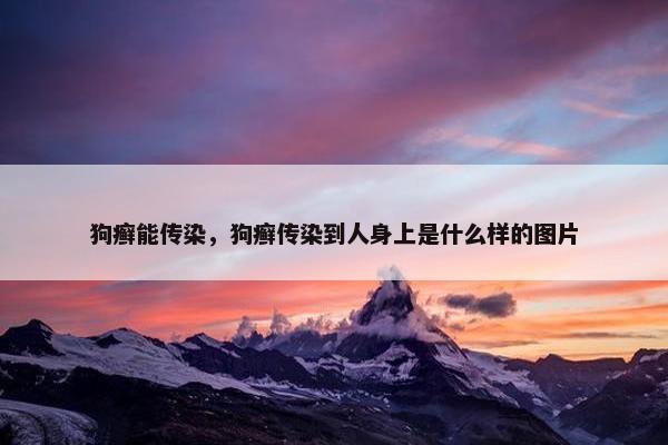 狗癣能传染，狗癣传染到人身上是什么样的图片
