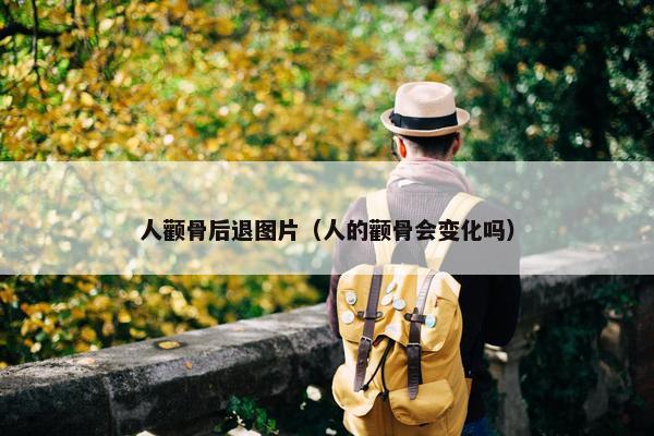 人颧骨后退图片（人的颧骨会变化吗）